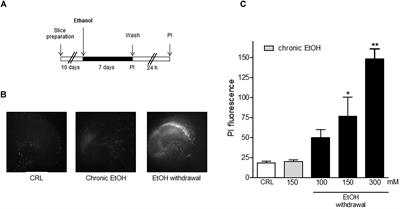Glutamate Receptor-Mediated Neurotoxicity in a Model of Ethanol Dependence and Withdrawal in Rat Organotypic Hippocampal Slice Cultures